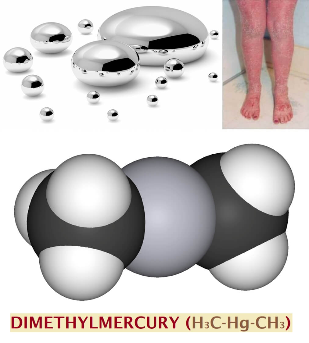 mercury deadly poison