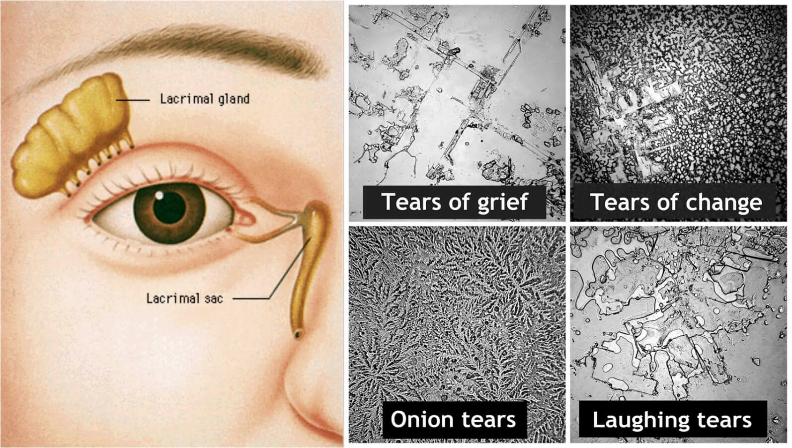 lacrimal gland and onion cry tears